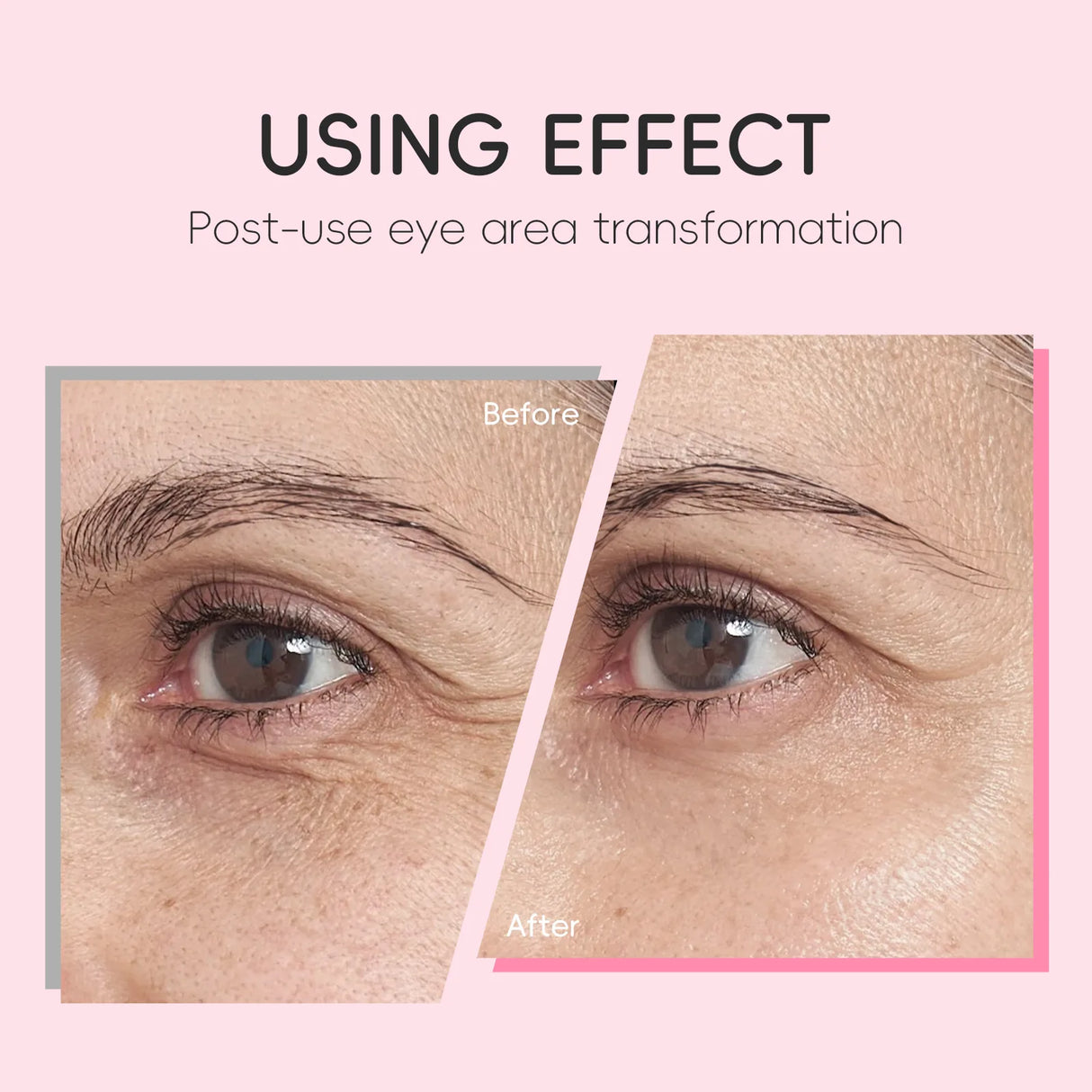 LAIKOU Sakura Roller Eye Serum 15ml Moisturizing Eye Care Reduce Dark Circles Puffiness Fine Lines Anti Aging Brightening Eye
