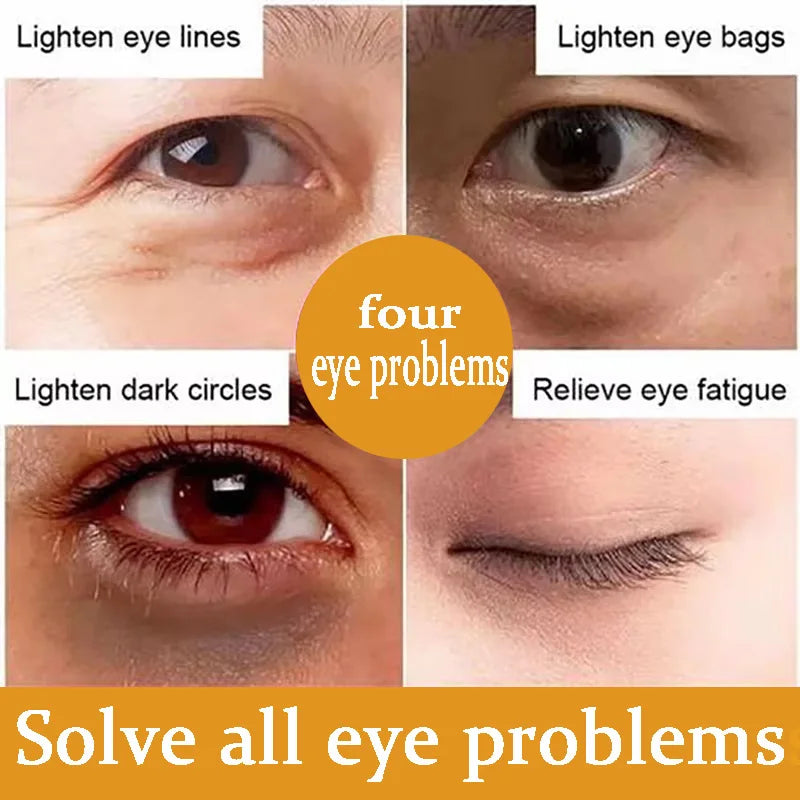 Anti Dark Circle Eye Serum Oil Retinol Anti Wrinkle Firming Lift Skin Remove Eyes Bag Fade Fine Line Whitening Brighten Eye Care