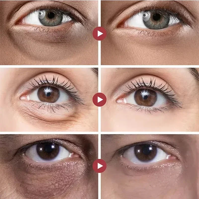 Anti Dark Circle Eye Serum Oil Retinol Anti Wrinkle Firming Lift Skin Remove Eyes Bag Fade Fine Line Whitening Brighten Eye Care
