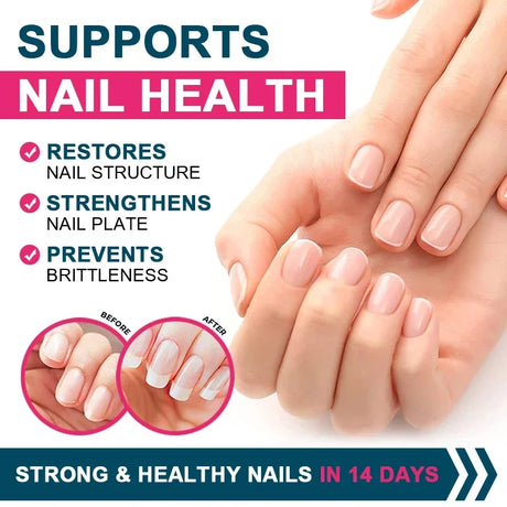 Multiple Collagen Complex - Types I, II, III, V, and X - Hair, Skin, Nail, Bones, Joint Health Support