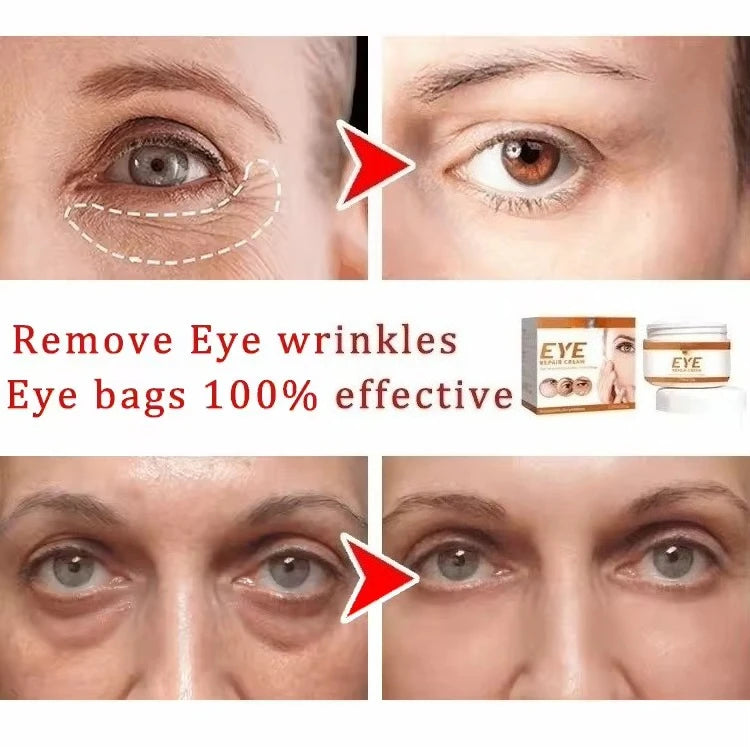 9selling wrinkle removing eye cream, eye bags, dark circles, anti swelling, firming, brightening, fine lines, moisturizing tool