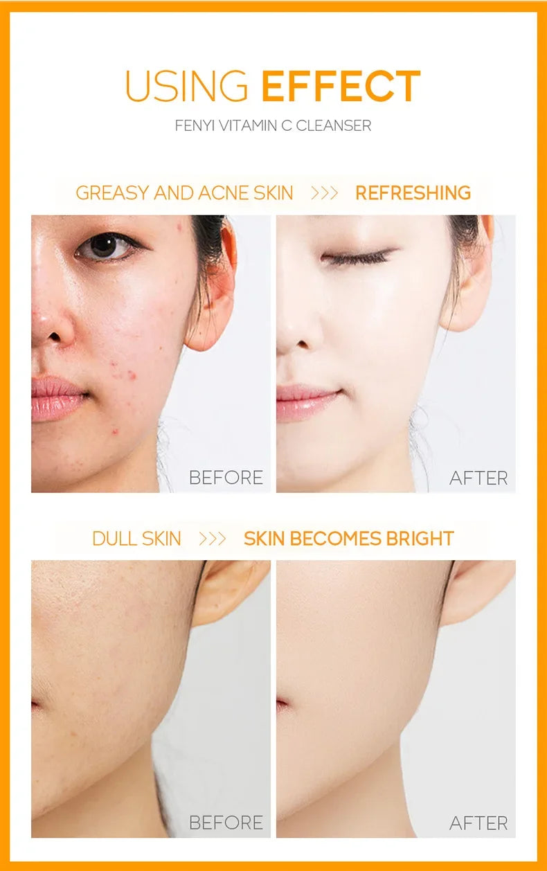 Japanese Cherry Blossom or Vitamin C Facial Cleanser Skin Cleansing Moisturizing Blackhead Remove Skincare Face Wash Foam Face