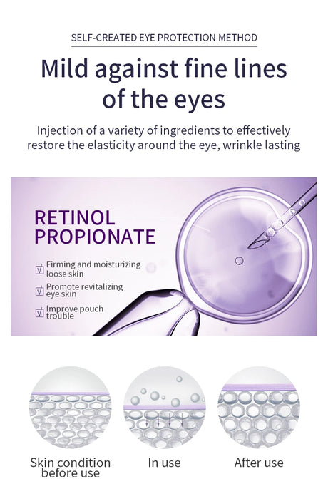 O'CHEAL Anti Wrinkle Anti Dark Circle Eye Cream Roller Massager Moisturizing Eye Bags Anti Aging Hyaluronic Acid Eye Skin Care