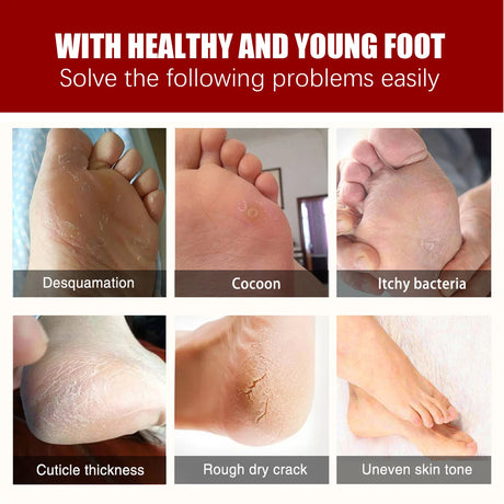 Exfoliating Feet Mask Sock Exfoliation Scrub for Feet Mask Remove Dead Skin Moisturizing Pedicure Anti Crack Foot Patch Spa 5PCS