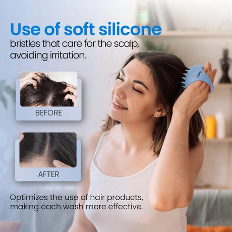 Hair Scalp Massager Shampoo Brush Scalp Exfoliator for Dandruff Removal for Hair Growth Wet Dry Scalp Exfoliator Brush