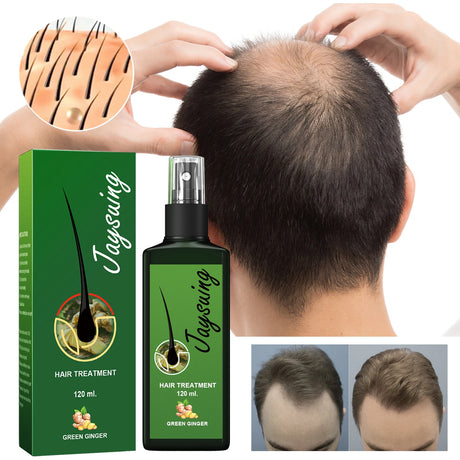 Hair Care Spray Ginger Massage Scalp Improve Dry Damaged Serum Smooth Nourish Repair Roots Anti Hair Loss Essence For Men Women