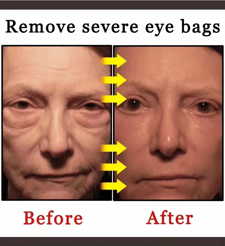9selling wrinkle removing eye cream, eye bags, dark circles, anti swelling, firming, brightening, fine lines, moisturizing tool