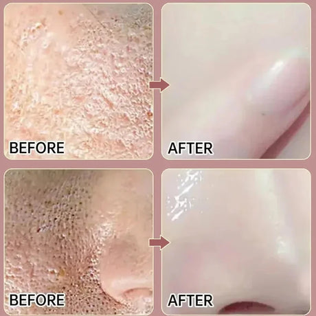 Remove Large Pores Serum Salicylic Acid Facial Pore Shrinking Tightening Pore Minimizing Firming Smooth Essence Korean Skin Care