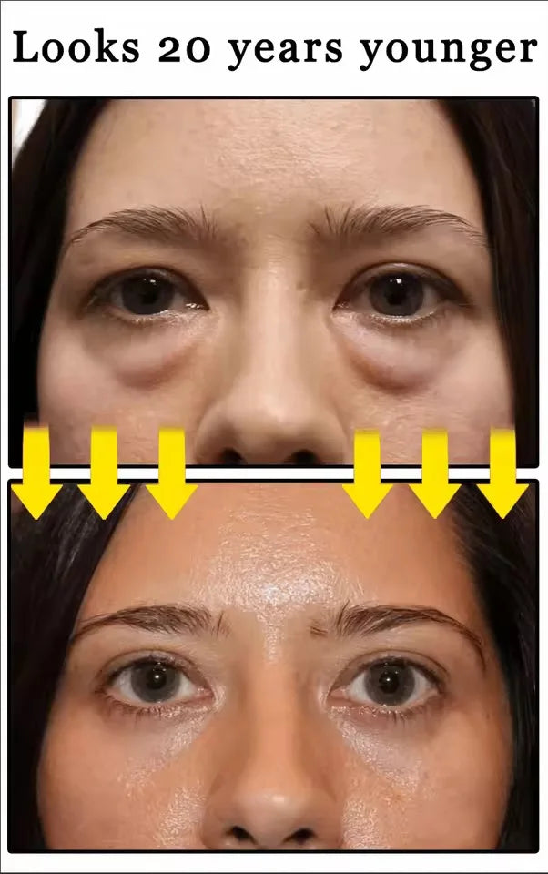9selling wrinkle removing eye cream, eye bags, dark circles, anti swelling, firming, brightening, fine lines, moisturizing tool