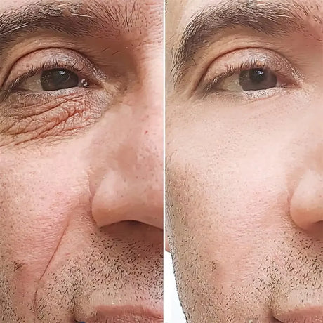 Retinol Eye Bag Removal Cream For Men Anti-Wrinkle Firming Skin Fades Fine Lines Anti Dark Circle Puffiness Brightening Eye Care