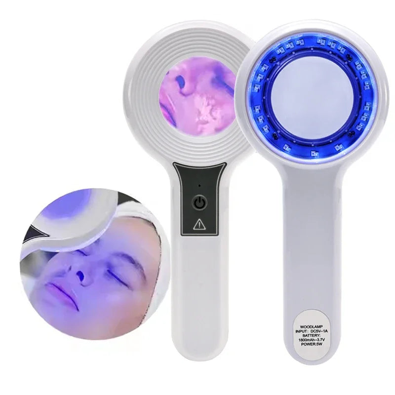 NEW Professional Dermatoscope Skin Medical Magnifier Detection Woods Lamp UVA Lamp For Vitiligo Detection