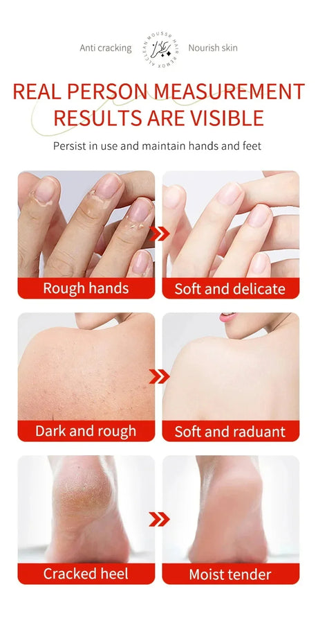 Herbal Anti Crack Foot Cream Heel Cracking Repair Products Exfoliation Dead Skin Removal Softening Moisturize Smooth Skin Care