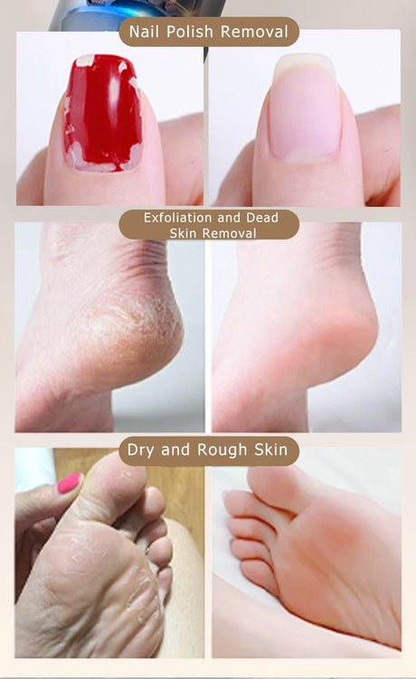 Aluminum Alloy 2-in-1 Electric Callus Remover And Food Grinder Hand Foot Care Tool Set with Gift Box