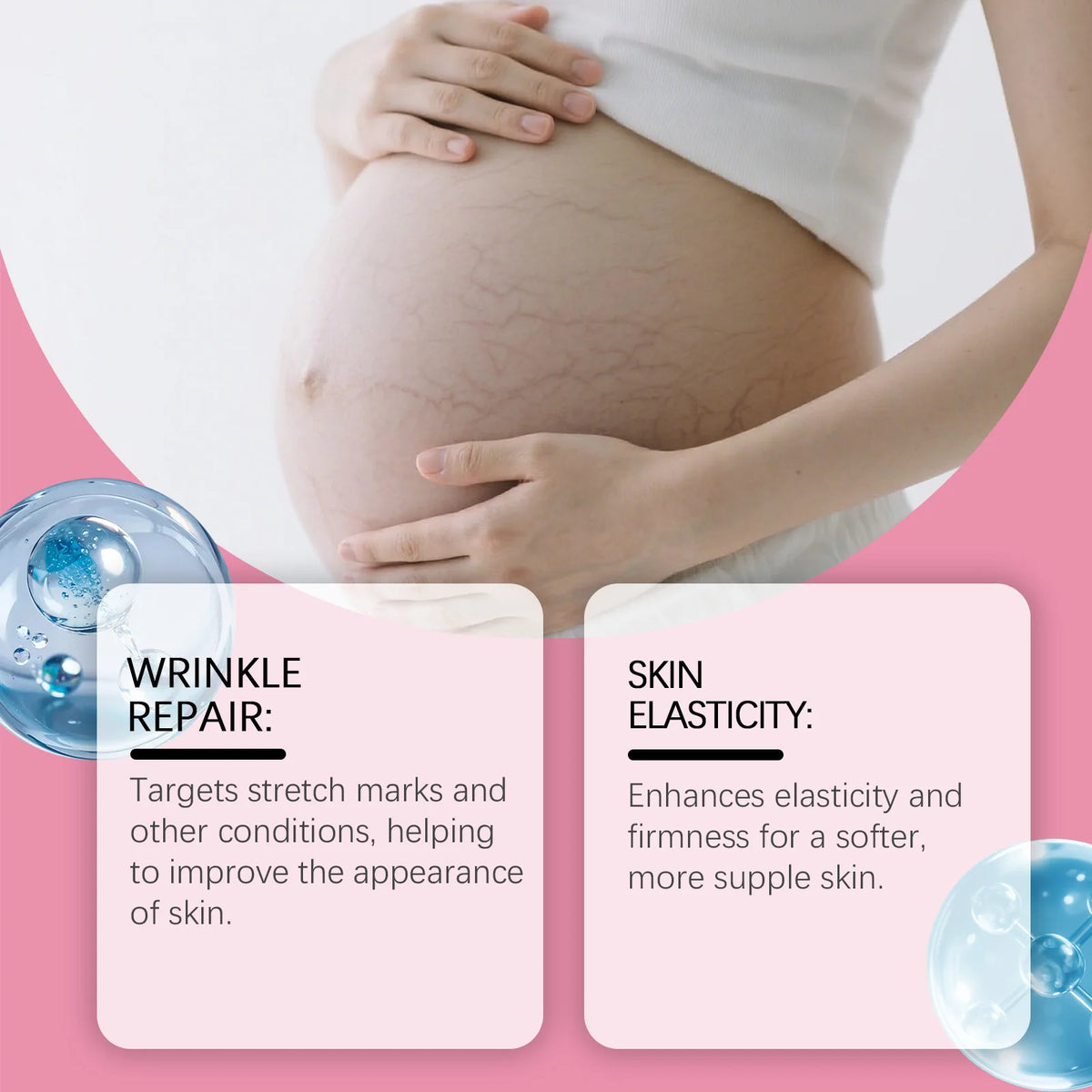 Pregnancy Belly Stretch Mark Cream for Elasticity Caffeine & Arnica Body Moisturizer Soothing Itchy Dry Skin Care for Moms to Be