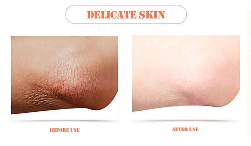 Body Whitening Soap Deep Skin Bleaching Brighten Body Scrub Knees Intimate Parts Armpits White Nourishing Care Soap