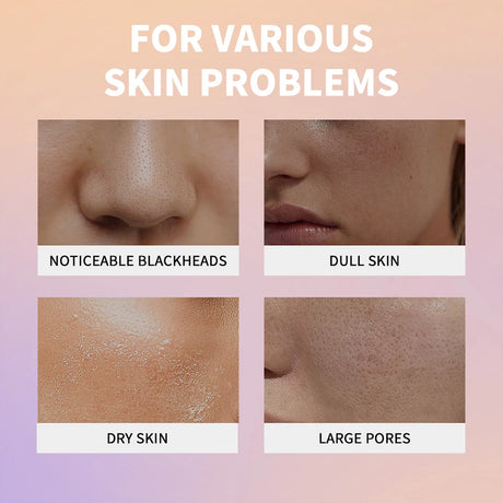 Rice Peeling Ampoule Soft Exfoliating Face and Body Scrub Dead Skin Cells Blackhead Remover for All Skin Types korean skin care