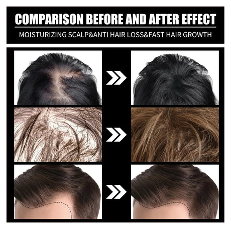 Biotin Hair Oil Collagen Scalp Serum Strengthening Treatment Natural Rosemary Ginseng Extract Thicker Volume Care For All Types