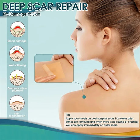 Silicone Scar Sheets - Reusable Scar Tape for Keloid, C-Section, Surgery, Burn, Acne - Waterproof, Hypoallergenic, Latex-Free