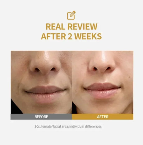 2026 Kojic Acid Niacinamide Brightening Ampoule Lighten Spots Fade Fine Lines Increasing Elasticity Smooth Soften Skin Care 1PCS