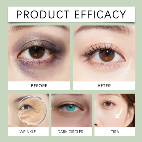 Hyaluronic Acid Eye Mask Under Eye Mask Anti Dark Circles Remove Eye Bags Improves Dullness Moisturizing Hydrating Eye Patches