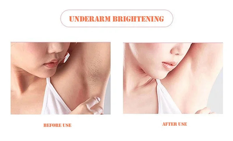 Body Whitening Soap Deep Skin Bleaching Brighten Body Scrub Knees Intimate Parts Armpits White Nourishing Care Soap