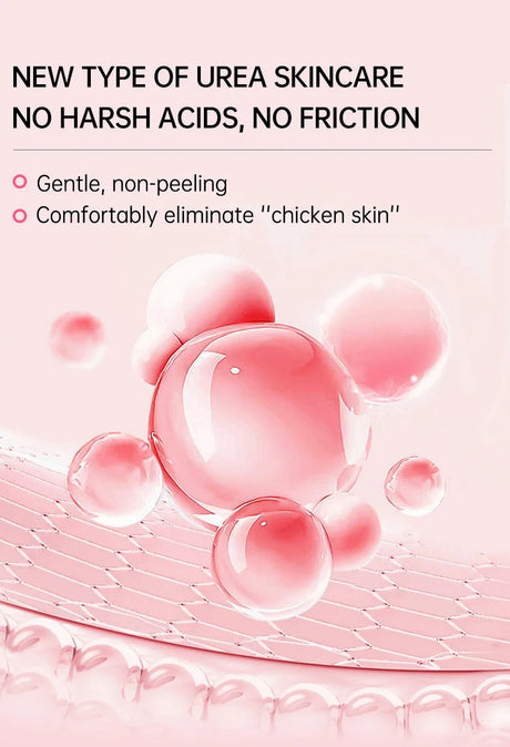 Chicken Skin Removal Cream Body Curing Keratosis Follicle Pore Spot Dull Treatment Whitening Moisturizing Body Care JoyPretty
