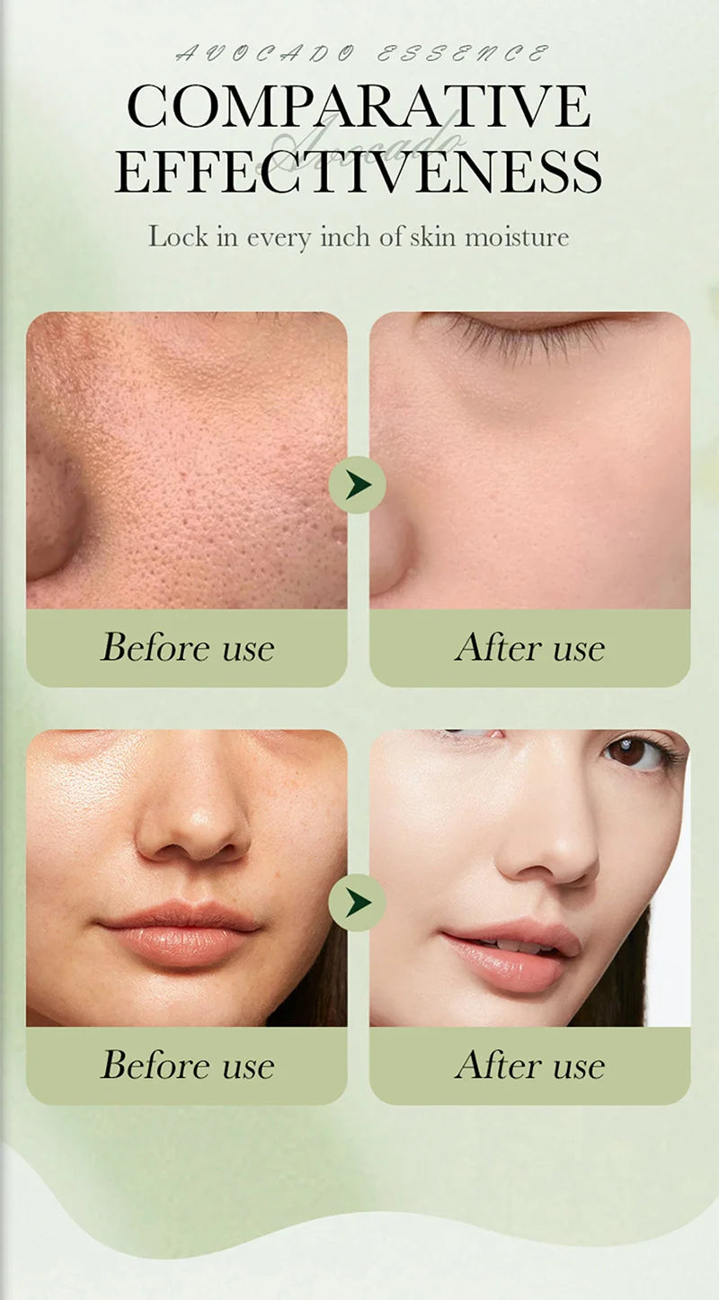 Avocado Skincare 6-Piece Set Includes Nourishing And Moisturizing Eye Cream, Face Cream, And Anti-Wrinkle Skincare Products.