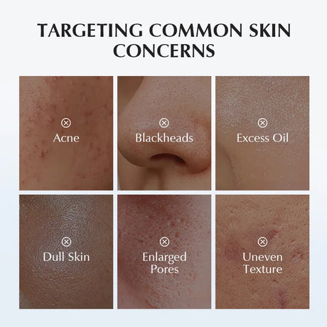 Korean Facial Cleanser – Salicylic Acid + Niacinamide, Blue Lotus & Lotus Extract for Fresh Clean & Oil-Balanced Skin