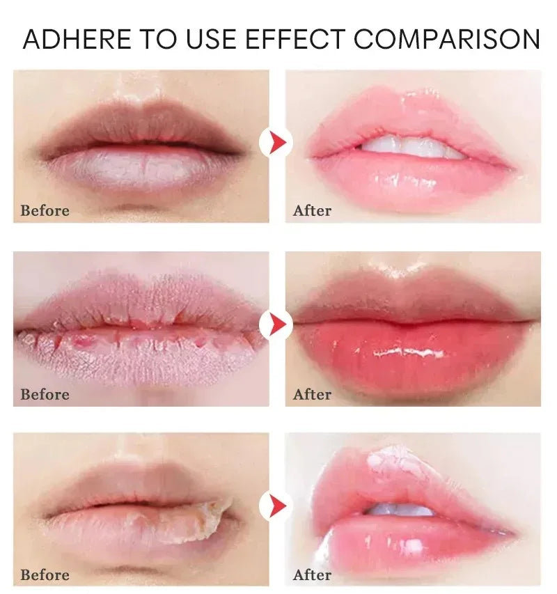 Moisturizing Lip Lines Moisturizing Lip Skin Jelly Lip Mask Moisturizing and Nourishing Repair Night Maintenance Lip Balm Care