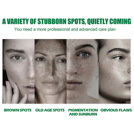 Dark Spot Correcting Glow Serum,Dullness,Acne,And Melanin Remover,Niacinamide Facial Skin Moisturizing Brightening Skincare