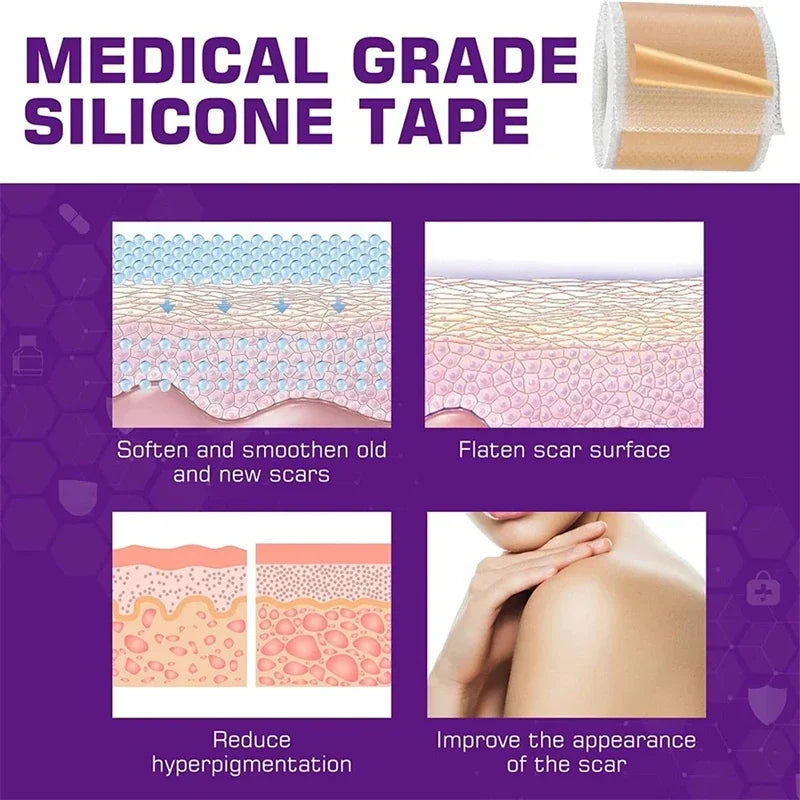 Silicone Scar Sheets - Reusable Scar Tape for Keloid, C-Section, Surgery, Burn, Acne - Waterproof, Hypoallergenic, Latex-Free