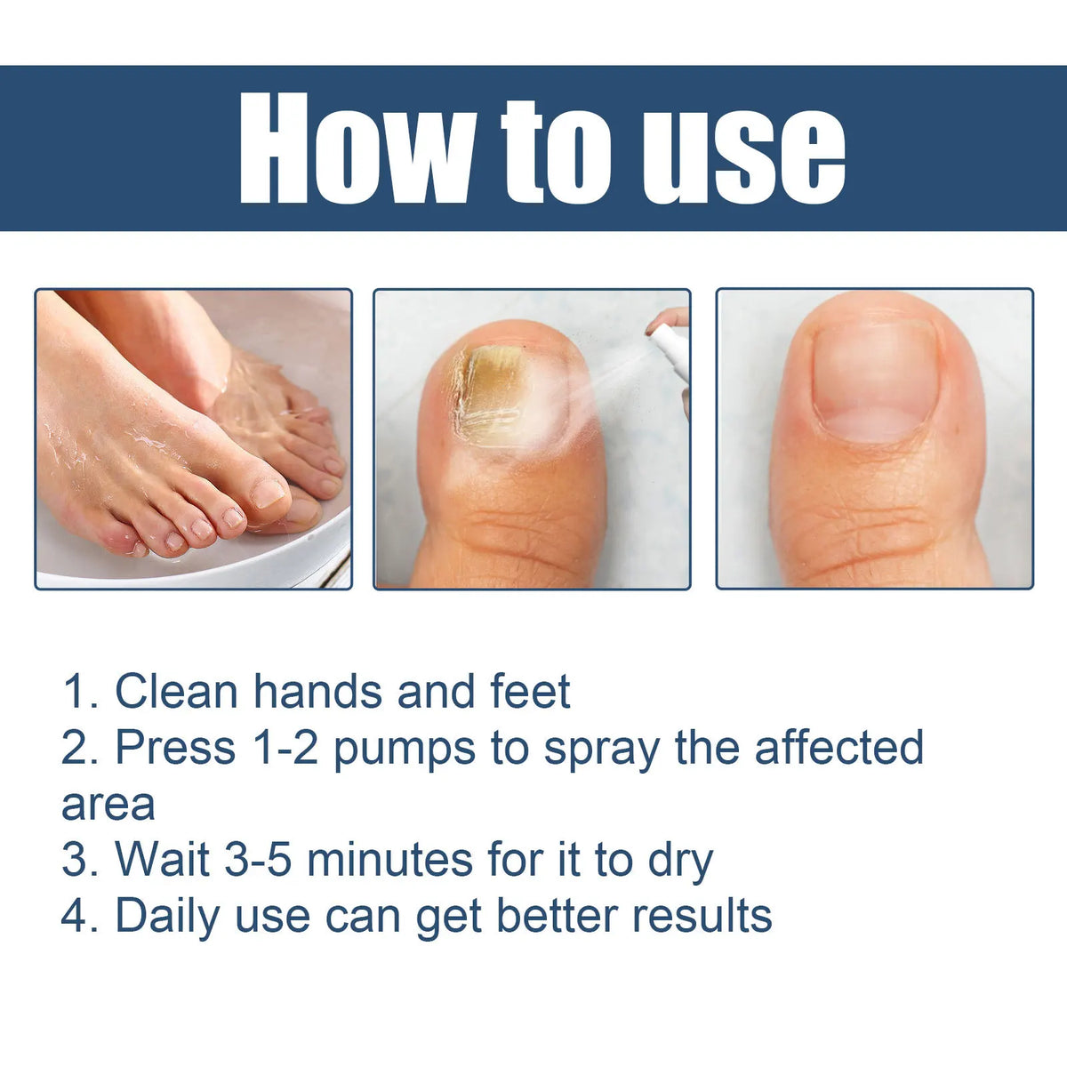 South Moon Foot Spray Anti Smell Remove Toenail Fungal Paronychia Onychomycosis Care Deodorant Antiperspirant Nail Repair Spray