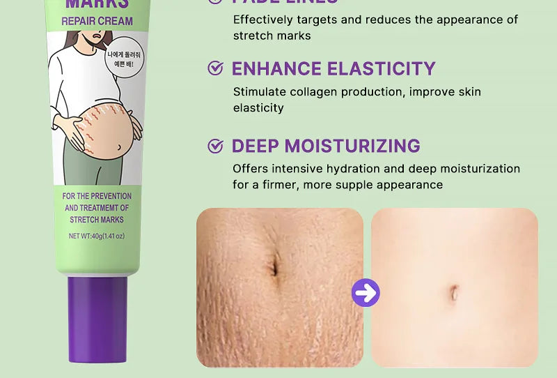 Stretch Marks Repair Cream Fade Lines Improve Duliness Tightness Long-lasting Moisturizing Smooth Enhance Elasticity Body Care