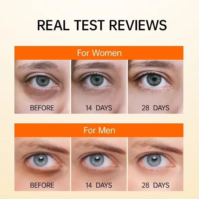 Anti Dark Circle Eye Serum Oil Retinol Anti Wrinkle Firming Lift Skin Remove Eyes Bag Fade Fine Line Whitening Brighten Eye Care