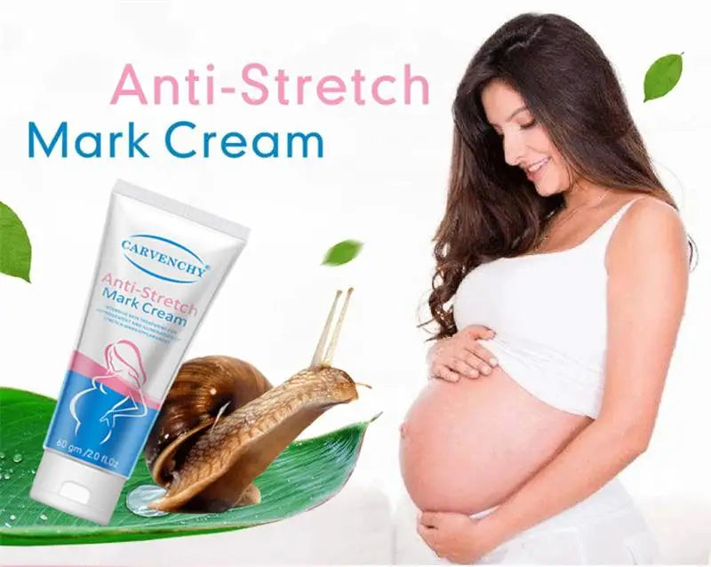 Snail Removes Stretch Mark Cream To Remove Postpartum Obesity Pregnant Women Repair Anti-Aging Anti-Winkles Firming Body Cream