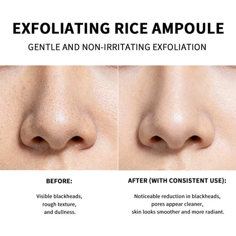 Rice Peeling Ampoule Soft Exfoliating Face and Body Scrub Dead Skin Cells Blackhead Remover for All Skin Types korean skin care