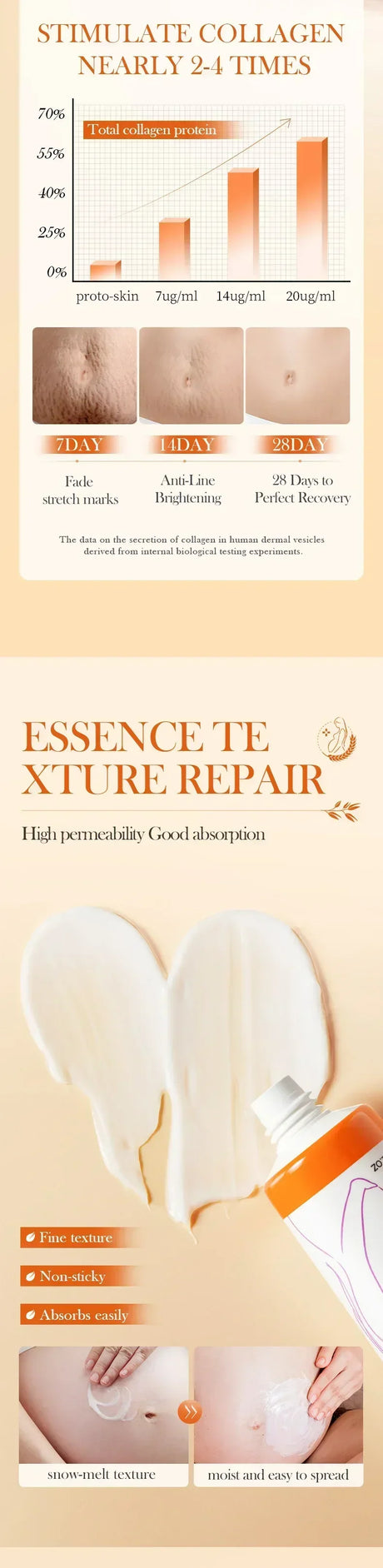 Cream For Pregnancy Stretch Marks Removal Eliminate Red White Old Stretch Marks 2025