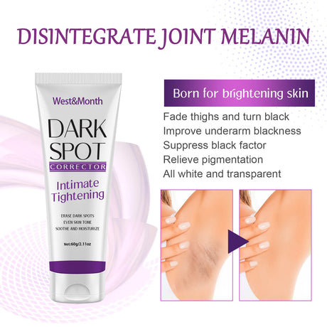 Body Whitening Lotion Dark Spot Remover For Underarms Knees Elbows Melanin Bleaching Lightening Skin Moisturizing Cream 60g