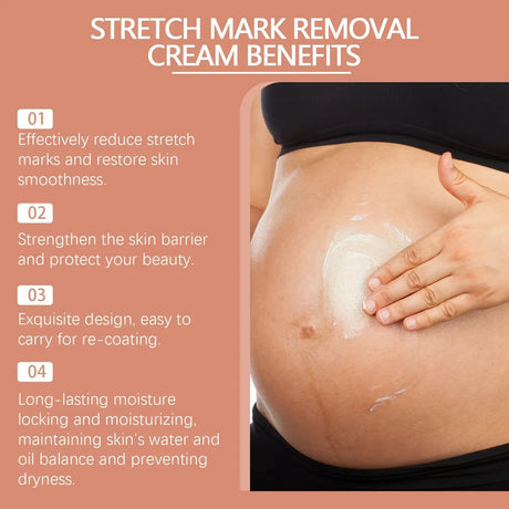 Cream For Pregnancy Stretch Marks Removal Eliminate Red White Old Stretch Marks 2025