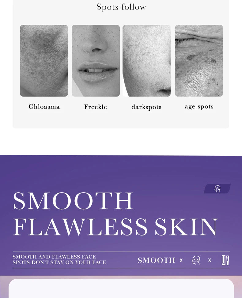 SADOER Nicotinamide Remove Melasma Dark Spot Whiten Freckle Cream Lighten Melanin Brightens Skin Tone Moisturize Face Skin Care
