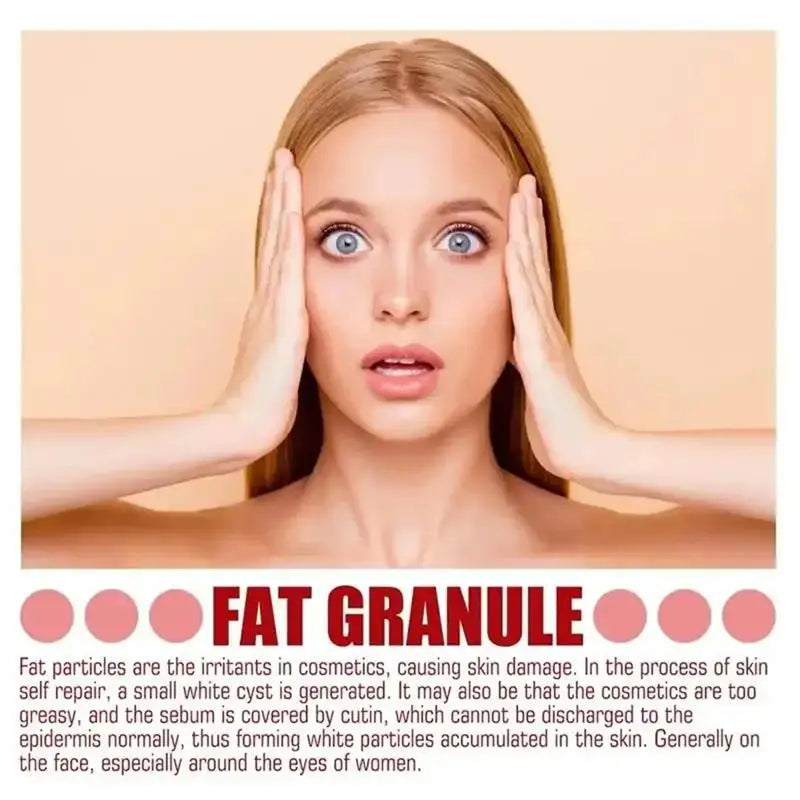 Fat Granules Remover Eye Cream Anti-Puffiness Anti Inflammatory Reduce Dark Circles Eyebags Fade Lines Moisturizing Eye Care