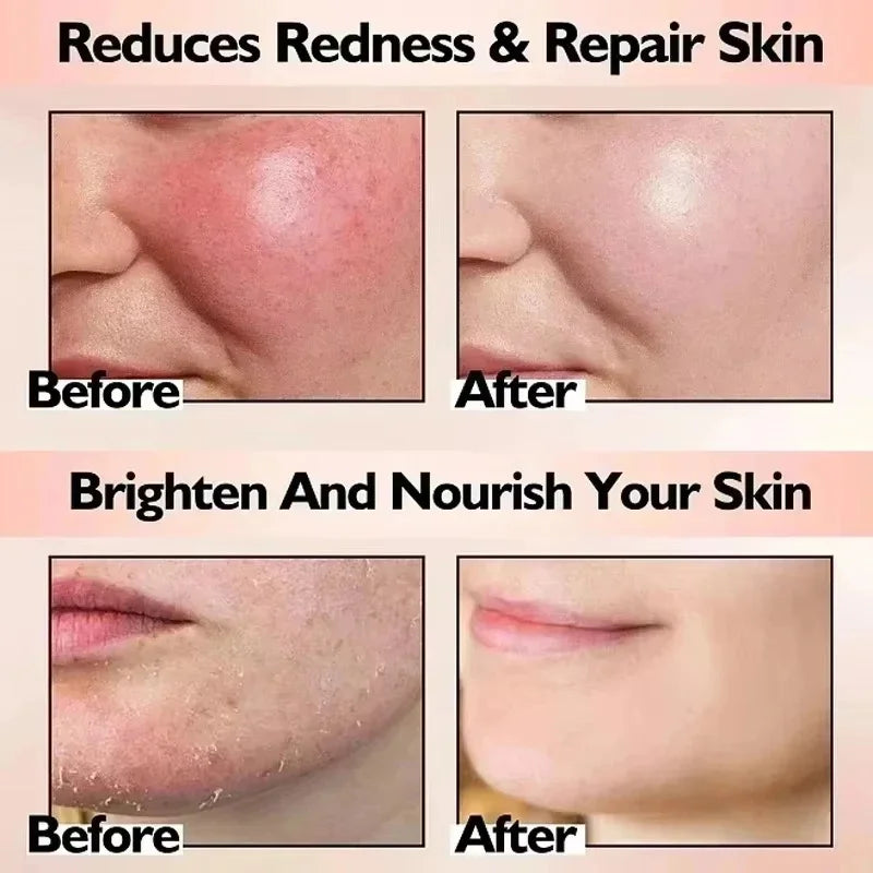 Facial Redness Repair Cream Improve Sensitive Skin Dryness Hydrating Sooth Lotion Removal Rosacea Day Night Korean Cosmetics
