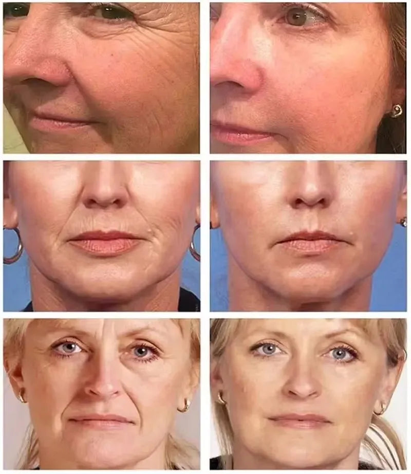 Instant Wrinkle Remover Face Serum Lifting Firming Fade Fine Lines Anti-aging Essence Whitening Brighten Nourish Skin Care