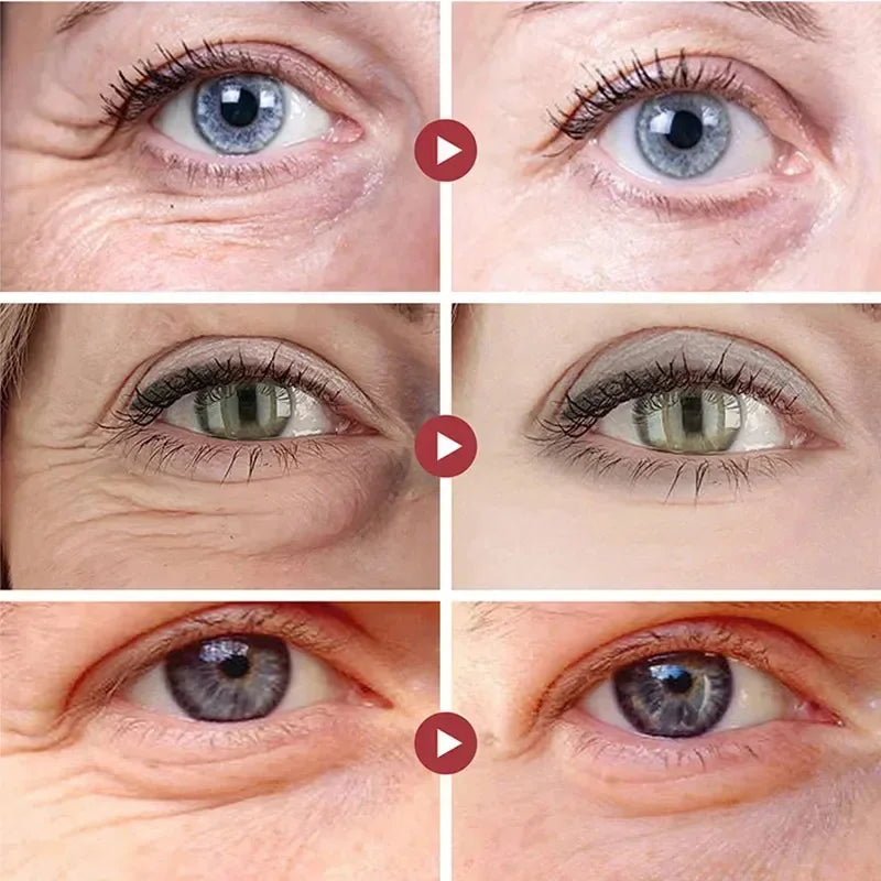 Collagen Eye Mask Essence Sakura Wrinkle Removing Eye Care Patches Fade Fine Line Anti Dark Circles Bag Anti-Puffiness Eye Care