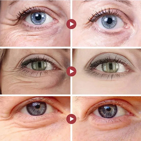 Collagen Eye Mask Essence Sakura Wrinkle Removing Eye Care Patches Fade Fine Line Anti Dark Circles Bag Anti-Puffiness Eye Care
