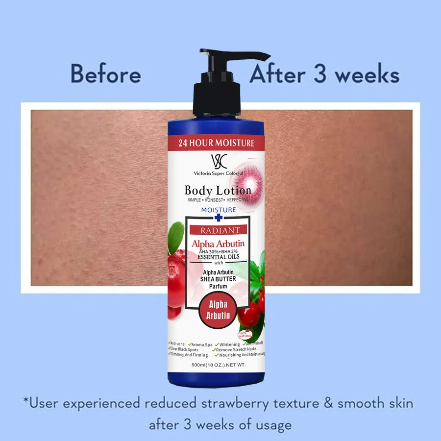 500ml Alpha Arbutin 30% AHA+2% BHA Whitening Body Lotion Glow Skin Brightening Moisturizer Hydrating Smoothing Body Cream
