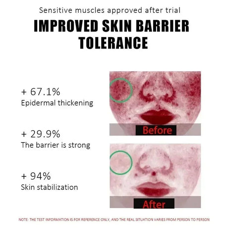 B5 Repair Cream Moisturizing Hydrating Effectively Solves Dry Chapped And Red Skin Nourishes Improve Repair Sunscreen Cream