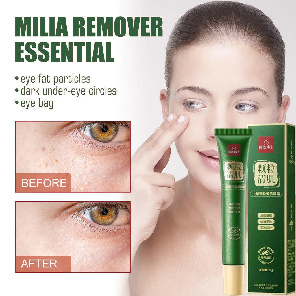 Fat Granules Remover Eye Cream Anti-Puffiness Anti Inflammatory Reduce Dark Circles Eyebags Fade Lines Moisturizing Eye Care
