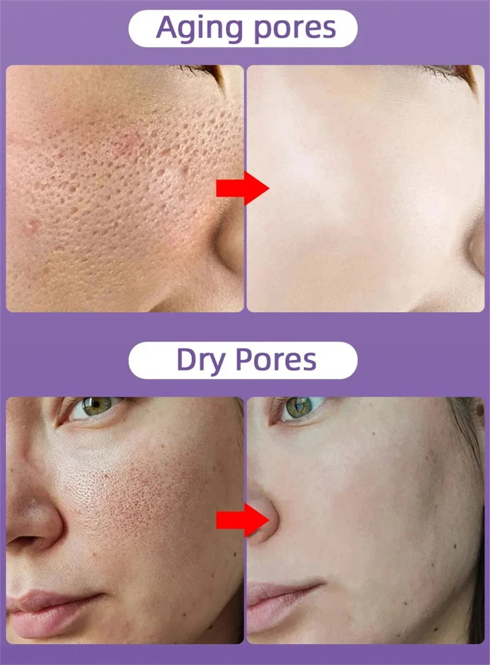 Salicylic Acid Pore Shrinking Cream Quick Elimination Large Pores Remove Blackehead Tighten Face Smooth Skin Korean Care Product