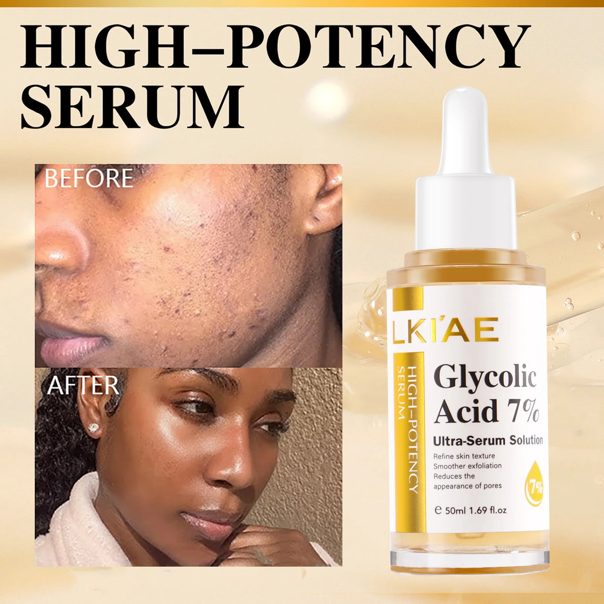 LKIAE Lightening Face Serum, Reduce Dark Spots Essence, With Centella Asiatica Extract, Fruit Acids, Niacinamide, 50ml/1.69 oz